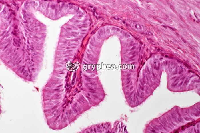 Trachée x100 - gryphea.com